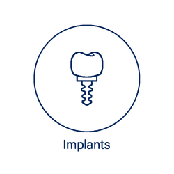 implants affordable dentist warkworth